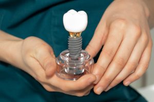 Impianti dentali over 50