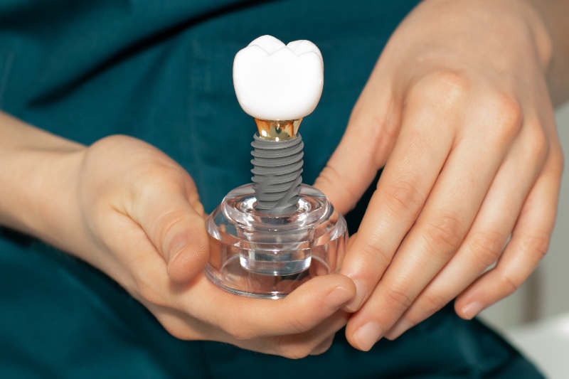 Impianti dentali over 50