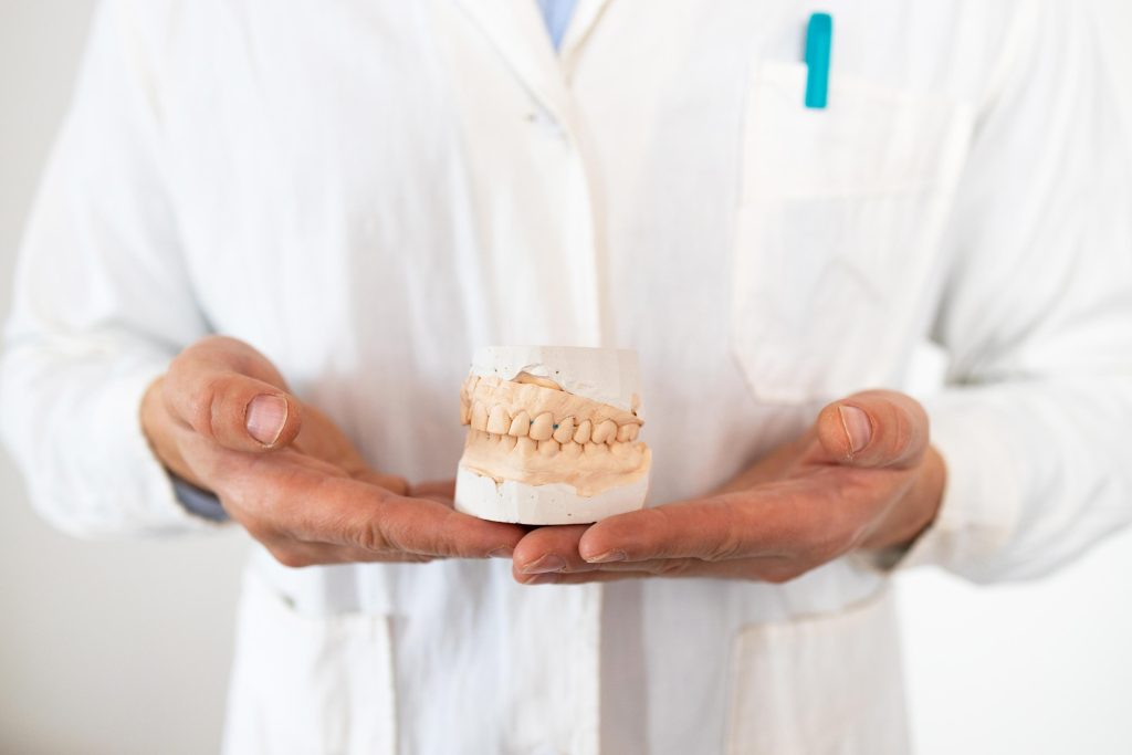 fallimento impianti dentali