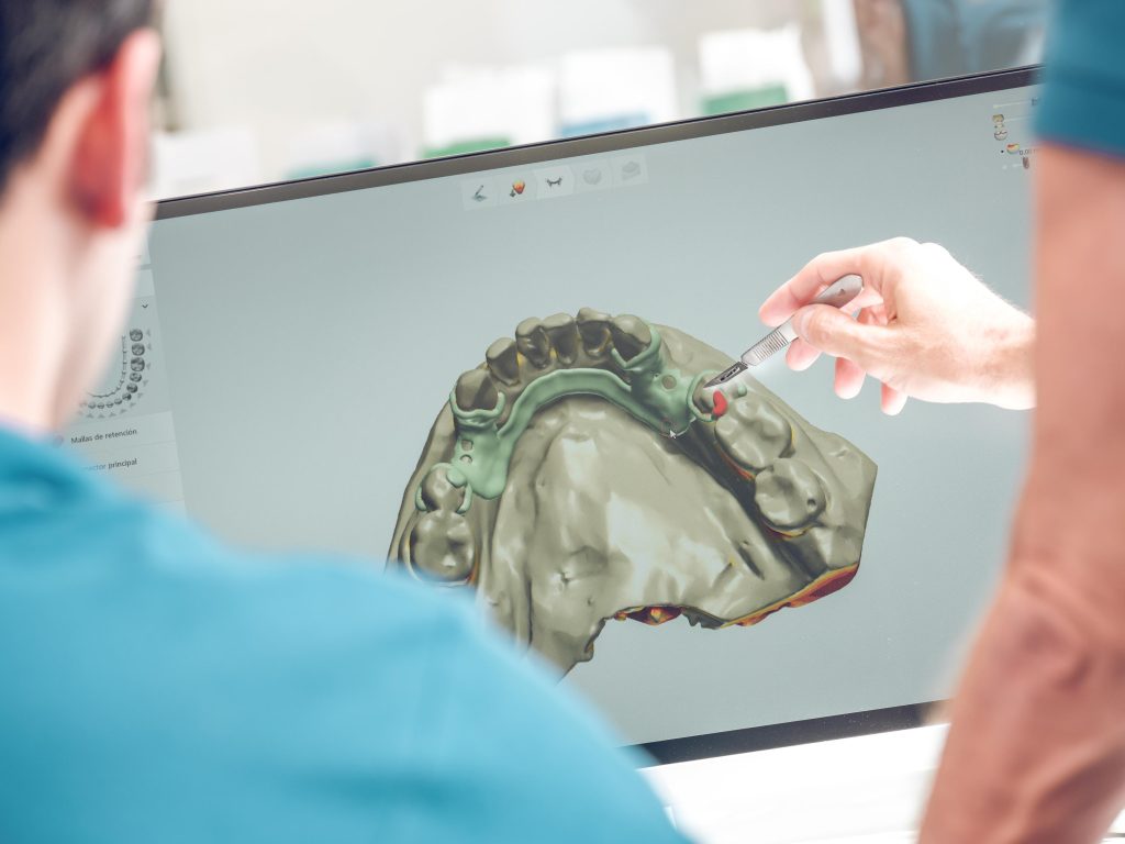 implantologia 3d