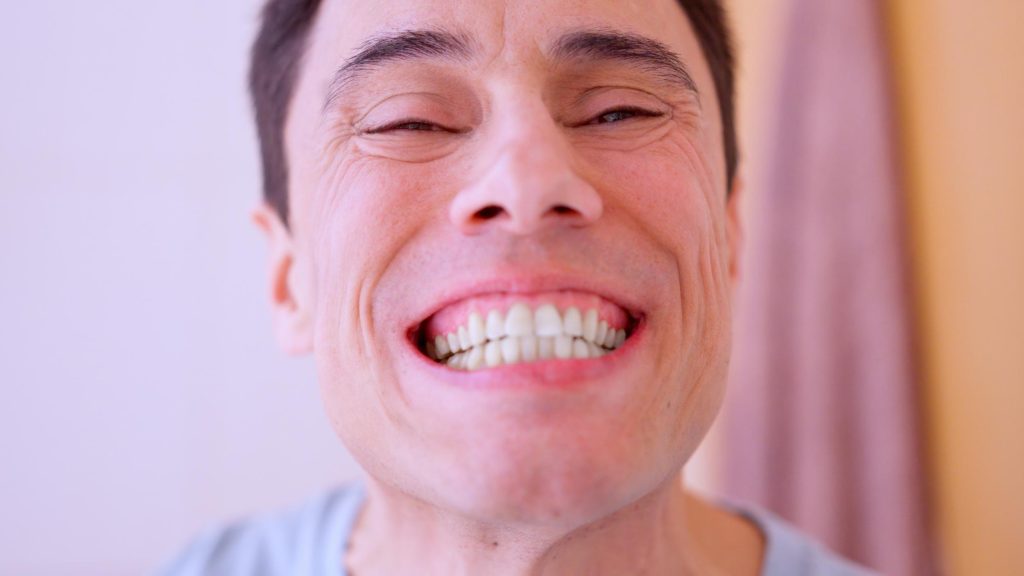 dente che si muove